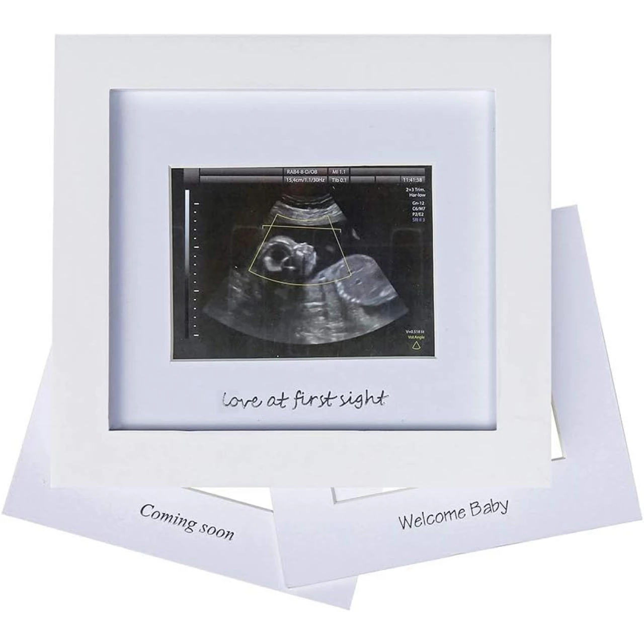 IHEIPYE Baby Sonogram Photo Frame - 1st Ultrasound Picture Frame