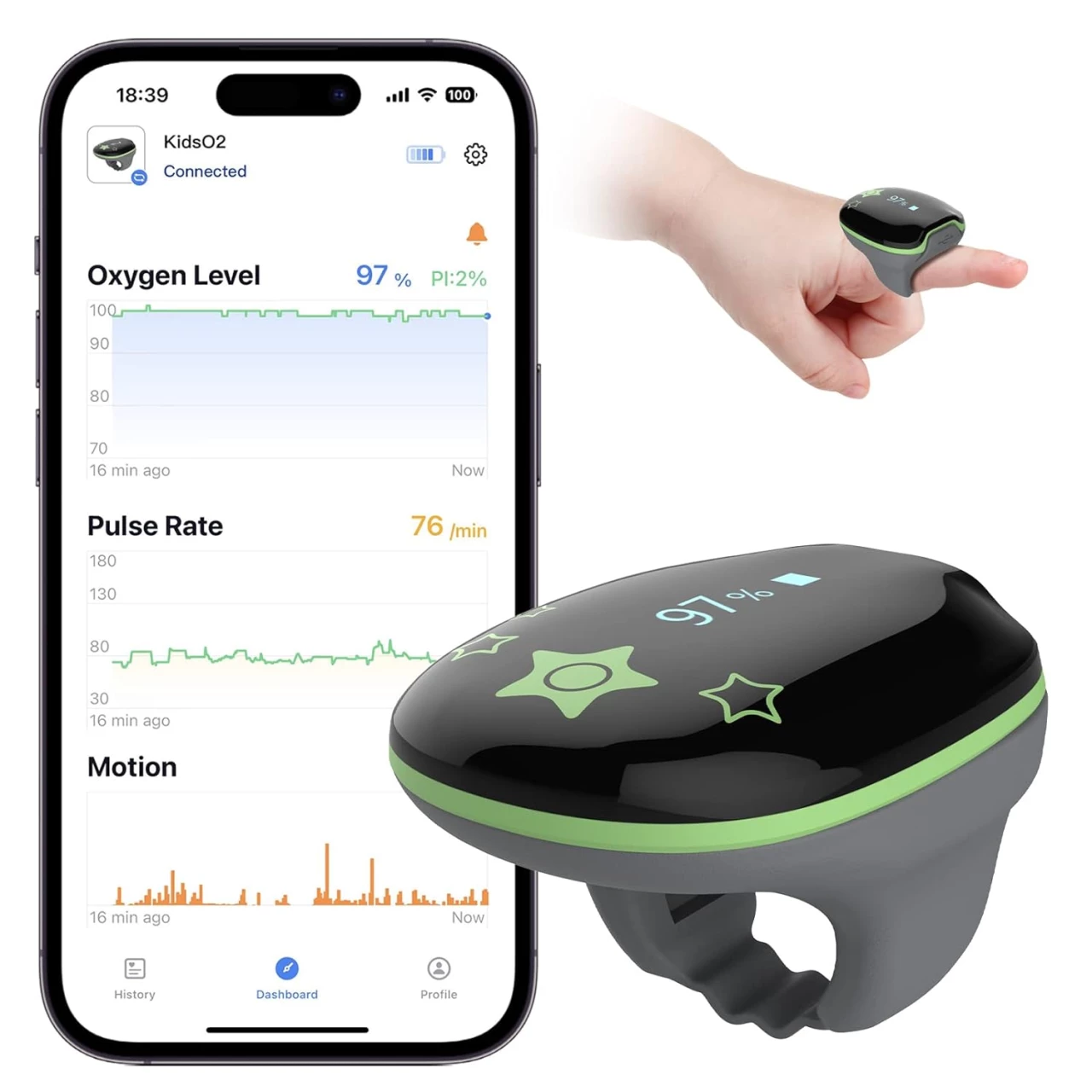 Wearpulse Children Pulse Oximeter KidsO2 Ring, Continuous Kids O2 Sat Monitor Finger for Oxygen with Audible Reminder, Rechargeable Pulse Ox Tracking Child&rsquo;s Blood Oxygen Saturation &amp; Pulse Rate for 3~10 Years Old Kids, with App &amp; PC Chart Report