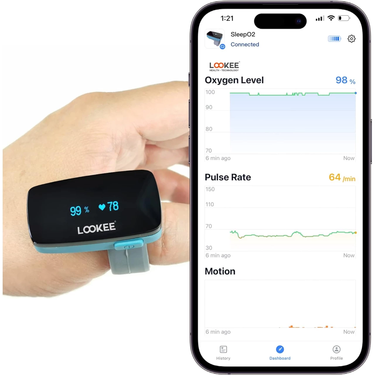 LOOKEE Ox-Minder Ring Continuous Pulse Oximeter | Bluetooth &amp; Wearable Oxygen Monitor