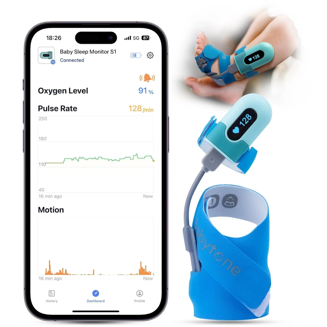 Babytone Baby Oxygen Monitor, Baby Sleep Monitor