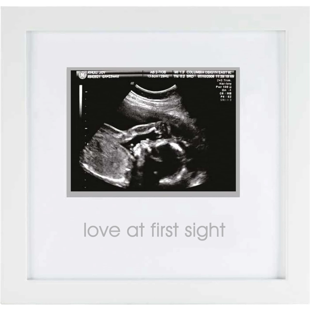 Pearhead Love at First Sight Sonogram Picture Frame